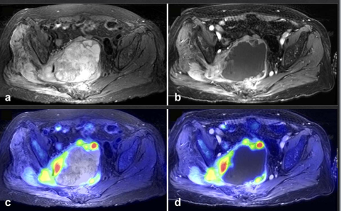 PET/MRI - MRC